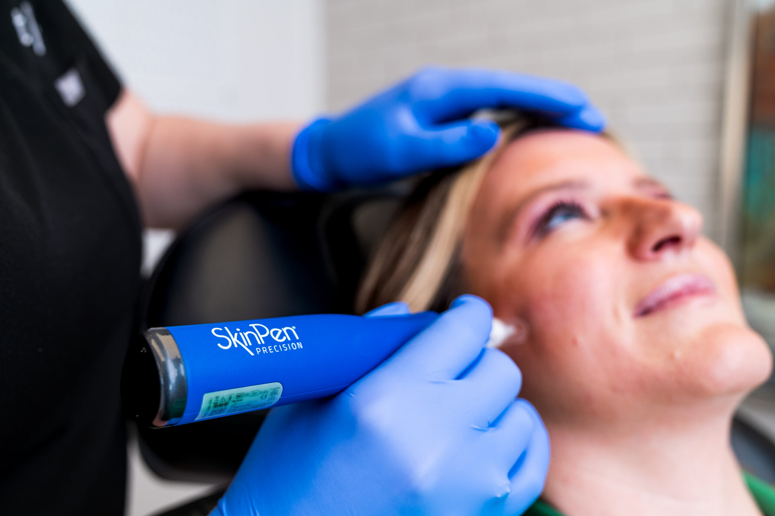A patient at The Lookshop Aesthetics receives the SkinPen microneedling treatment.