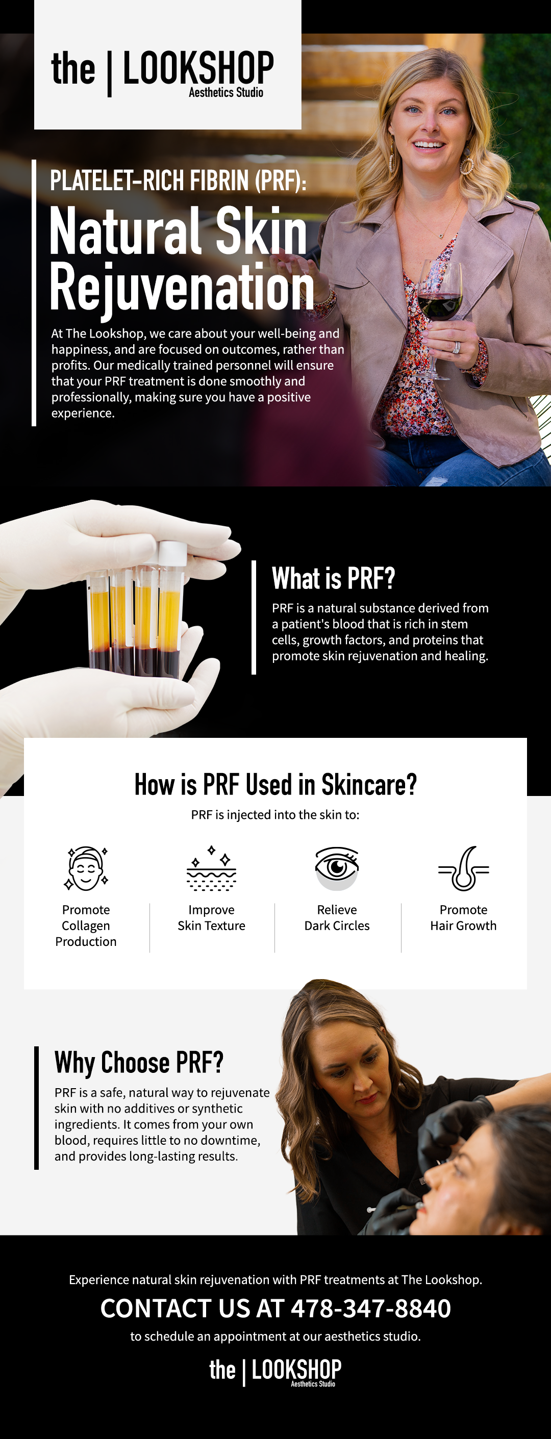 Face Fillers Forsyth GA