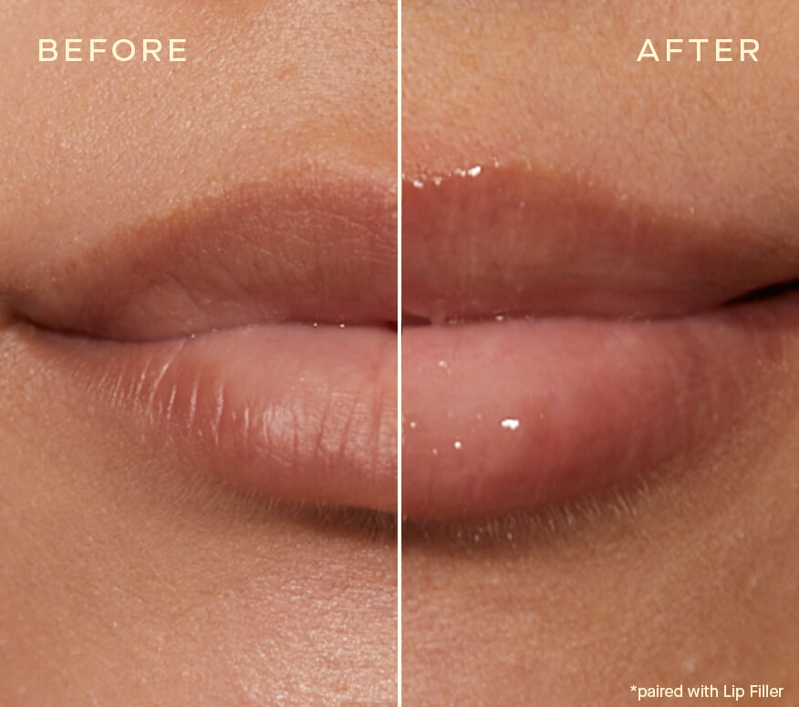 Ourself Lip Conditioner - Image 3